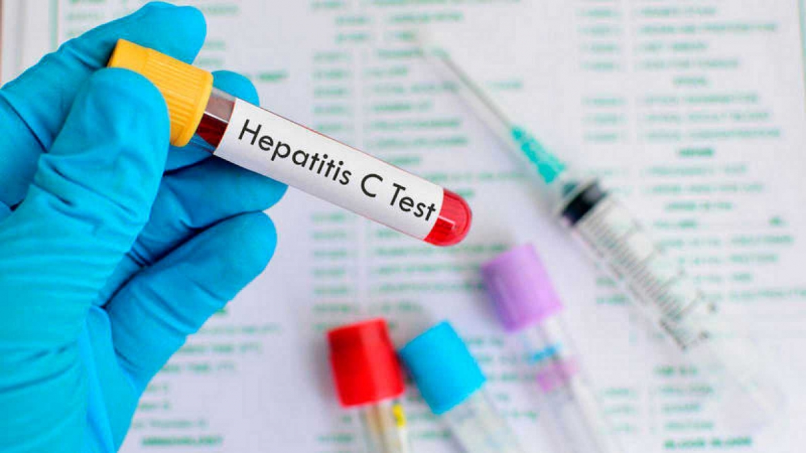 La Hepatitis C como oportunidad excepcional en la historia de la Medicina